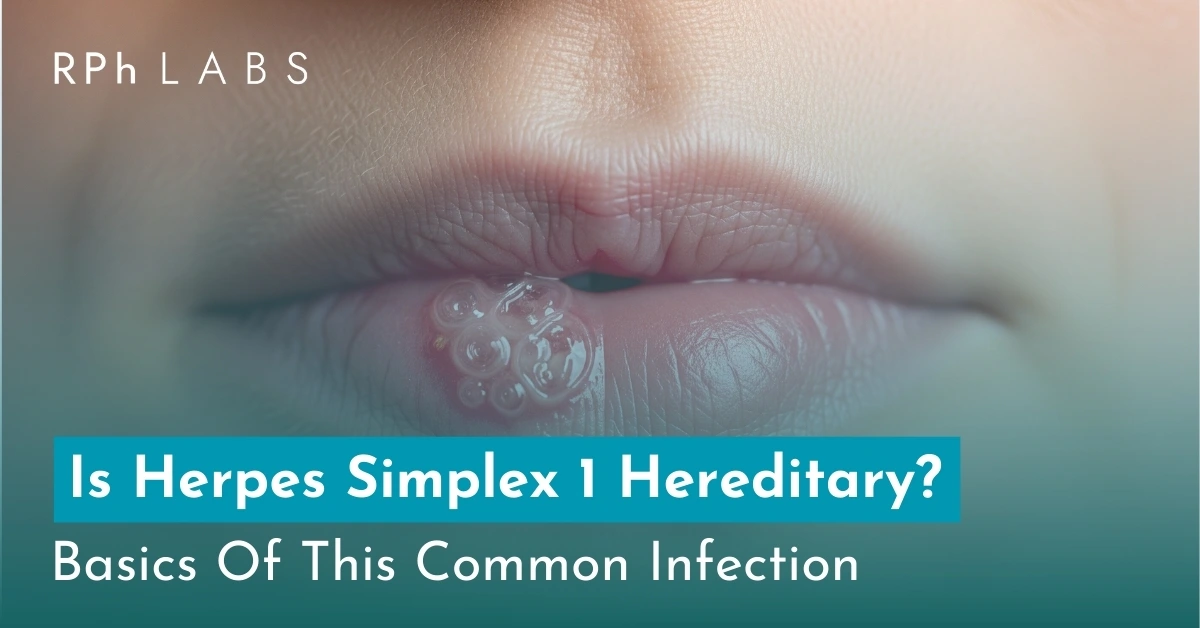 Is Herpes Simplex 1 Hereditary