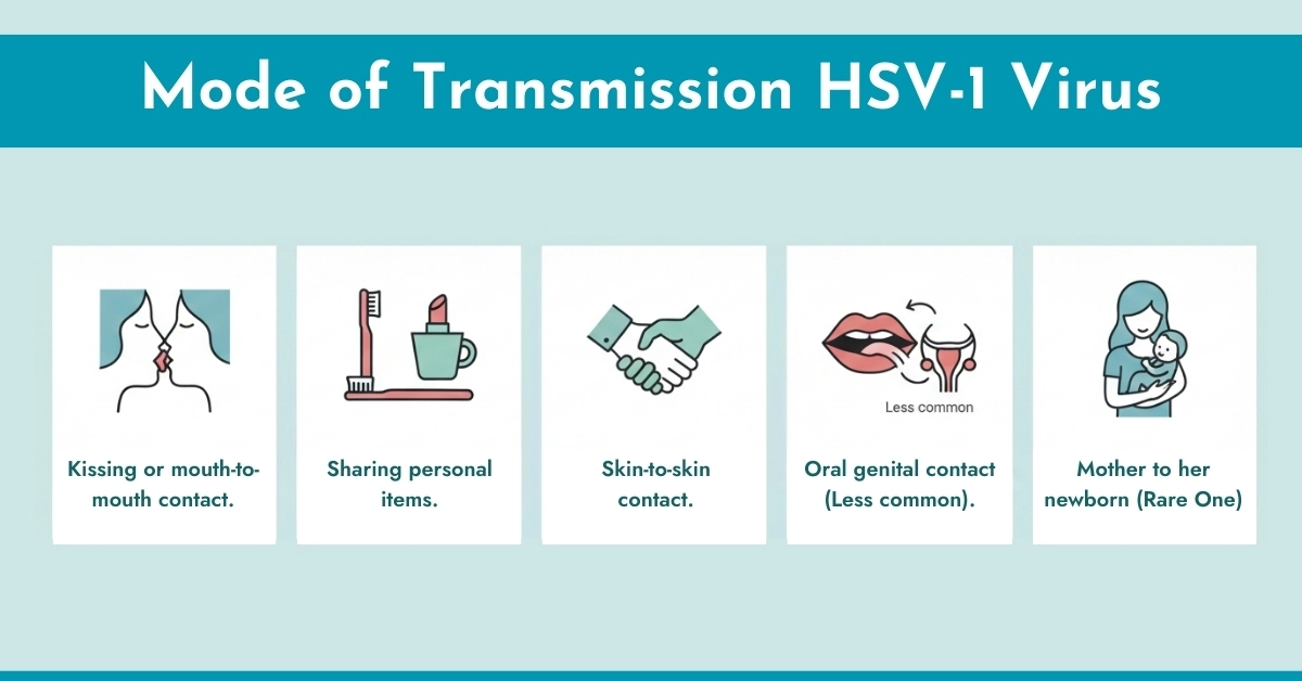 Mode of Transmission HSV-1 Virus